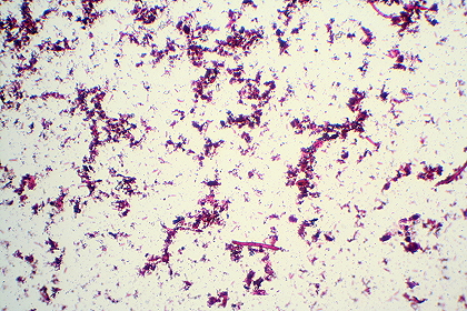 Bakterien unter dem Mikroskop