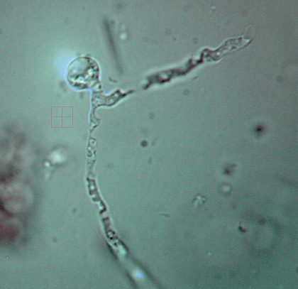 Thick-walled chlamydospores arising on pseudohyphae