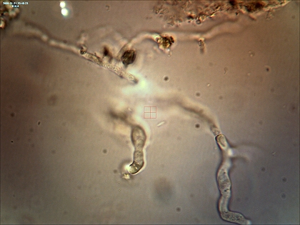 Candia albicans unter dem Mikroskop