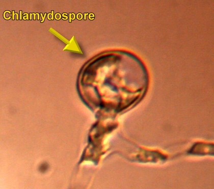 Chlamydospore