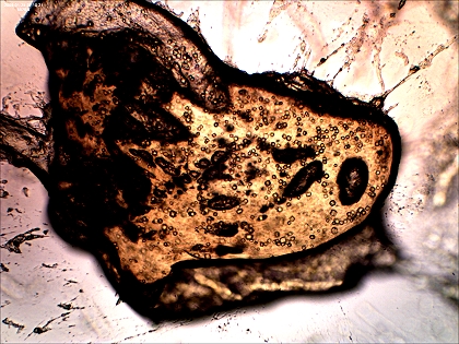 Mikroskop Aufnahme Fibrinschicht