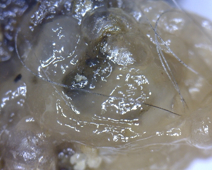 Großaufnahme der Fibrin Schicht