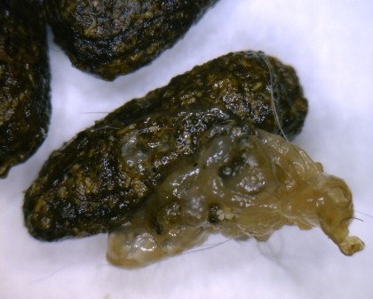 Fibrin überzogener Köttel