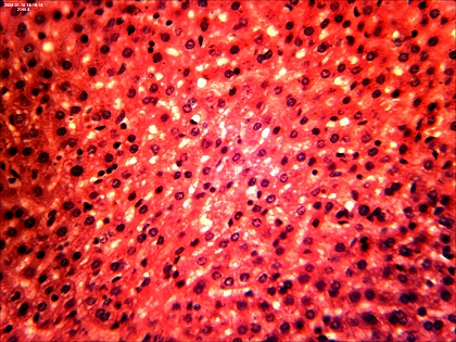 Leberkokzidiose