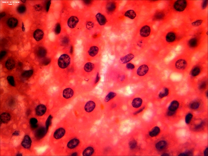 Leberkokzidiose