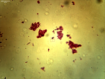 Sreptococcus lactis