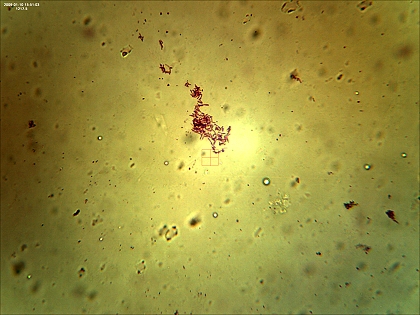Eiterbakterien - Staphyloccocus pyogenes