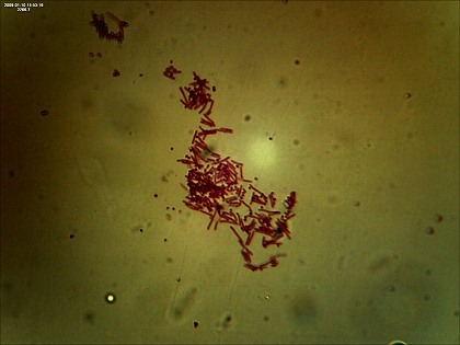 Eiterbakterien Staphyloccocus pyogenes