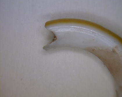 Schneidebereich dieses Zahnes ist nicht in Ordnung