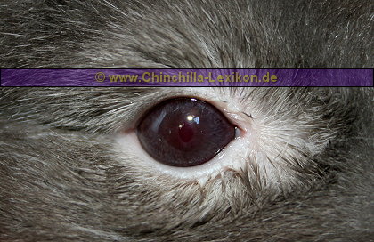 Tränendes Auge durch eine Zahnfehlstellung