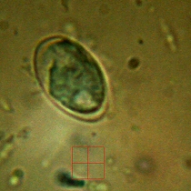 Chinchilla Giardia under microscope