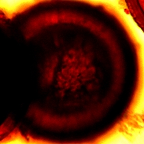 Worms under microscope