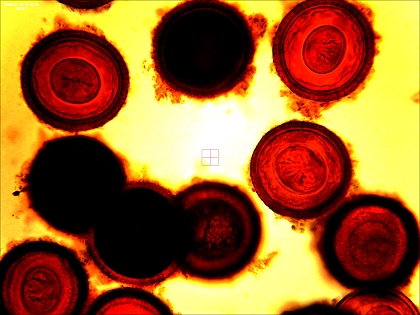 Bandwurmeier unter dem Mikroskop